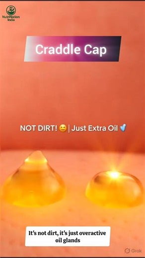 How to Safely Remove Cradle Cap in 3 Steps✅ #BabyCare #newparents #newborncare #babylearning #shorts