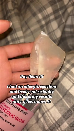 This is abit dirty but I had an allergic reaction and they are practically gone now !!! #getmefamous #tiktokshop #pimplepatches #promotion #spots @litbearofficial