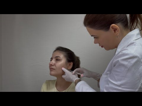 bruxism_esteticsana_chisinau