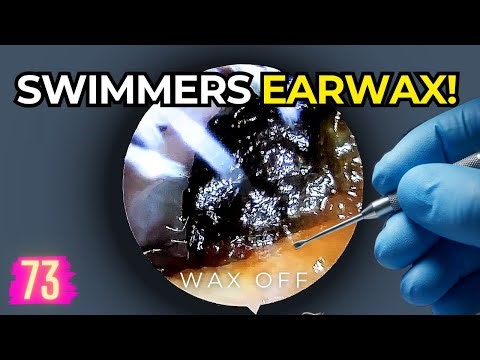 Deep Clean Earwax Removal For A Swimmer | Oddly Satisfying Wax Extraction | Wax Off Episode 73