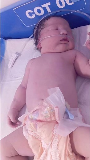 microsomic baby and there wighte are 4. 7 kg waith graunting complin