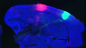 Scientists Turn Tastes On and Off by Activating and Silencing Clusters of Brain Cells