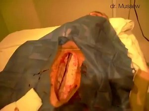 Is Surgery In Progress?