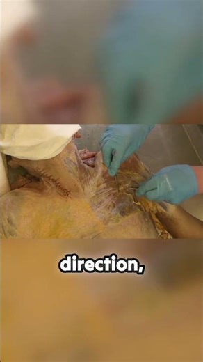 Why fascia changes direction: The 'continuity bag' explained