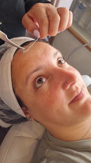 Collagen & Elastin Threads: Makes Improvement Of Skin Elasticity: Deliver the powerful effect of tightening & lifting your skin. The platinum gold extract from the spray can stimulate the regeneration of skin cell. #ansigtsbehandling #antiaging #københavn #facialtreatment #collagenthread