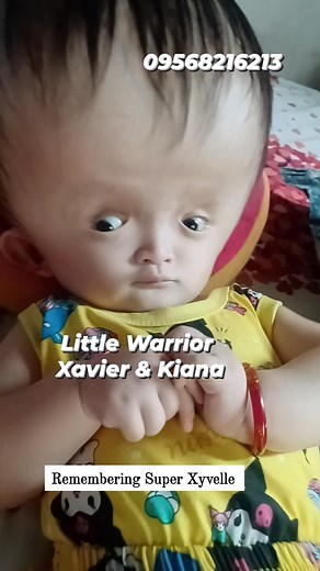 4.5K views · 349 reactions | Kiana & Xavier's update: Follow up po nila parehas ngayon sa NCH OPD Neurosurgery. Si Kiana magpapabasa ng MRI, si Xavier naman follow up dahil pinagpahinga siya ng 2 weeks after discharge then possible na uulitin na today ang laboratories and X-ray niya for clearance para sa surgery. Praying na sana magiging maayos ang check up ng dalawang babies na ito  | Remembering Super Xyvelle | Facebook