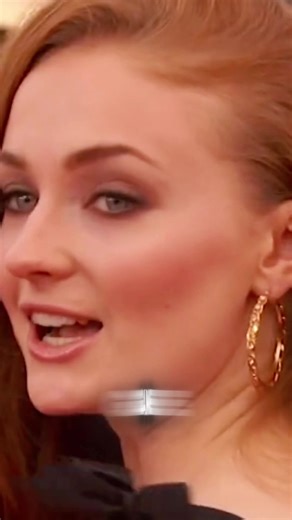 Did you know Sophie Turner was cast in Game of Thrones when she was just 13 years old? Turner landed the role of Sansa Stark at 13 and grew up on set, becoming one of the series’ standout actors as the show became a global phenomenon. #SophieTurner #GameOfThrones #DidYouKnow #SansaStark #ChildActor