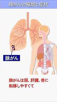 One-minute lecture on "Symptoms of Lung Cancer" by Dr. Sato, respiratory medicine specialist