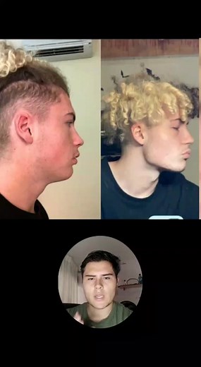 esta es la correcta forma de hacer mewing #mrmandibulas | como hacer mewing