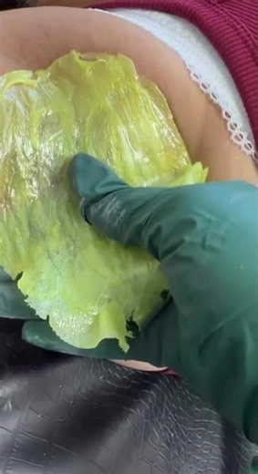 Armpit Waxing with Sexy Smooth Lemon Kiss Hard Wax by @queenwaxingandskinesthetics_ 🍋