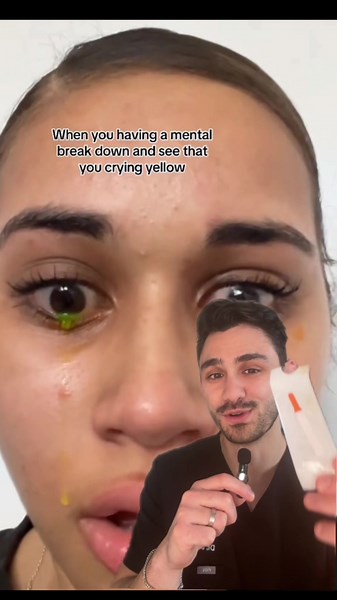 Understanding Crying Yellow Tears: Causes and Meanings