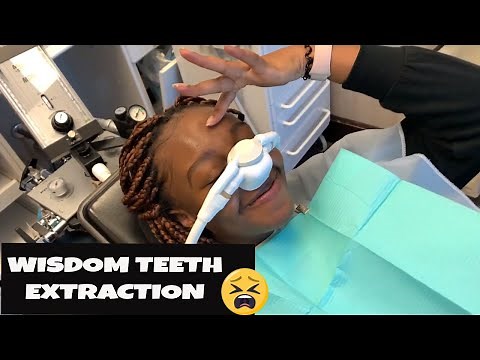 I GOT MY WISDOM TEETH TAKEN OUT | REMOVAL VLOG