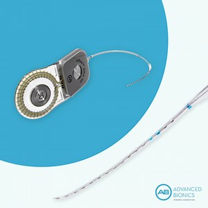 50 reactions · 15 shares | 僚 Most cochlear implants can stimulate the hearing nerve at the location of their electrode contacts (e.g., 22 or 24). Only AB uses current steering to fine-tune the stimulation to multiple points between each electrode pair in HiRes Ultra 3D, stimulating up to 120 unique points on the hearing nerve and offering 5 times the sound resolution of any other system. | Advanced Bionics | Facebook