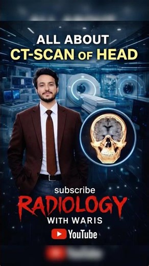 All About CT Scan of Head 🧠 | Radiology Made Easy | Subscribe Now! #shorts