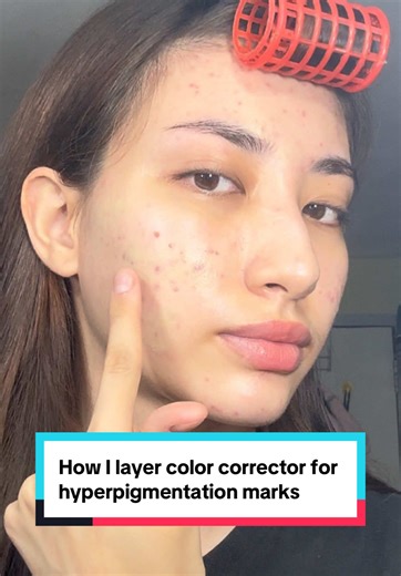 Layering Color Corrector for Hyperpigmentation Marks