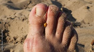 A ladybug beetle crawls on its toes. Women's foot on the background of beach sand. Healthy nails without onychomycosis. An insect on the human body. Golden hour on the beach. Summer outdoor recreation