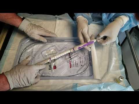 “One stop” liver-focused endoscopy: EUS-guided portal pressure gradient measurement technique