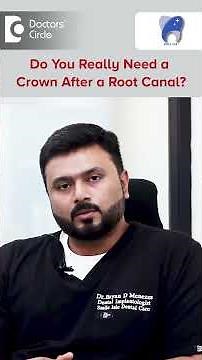 Why a Cap Is a Must After Root Canal Treatment - Dr. Bryan D Menezes | Doctors' Circle
