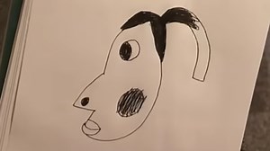 Is That Hyperpigmentation? | Know Your Meme