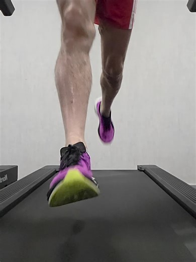 Improving Over Pronation for Better Foot Health
