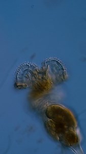 15K views · 4.7K reactions | This is a wheel-animal, a rotifer. The...