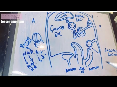 Lesser Sac | Omentum | Peritoneum tracing | Epiploic foramen