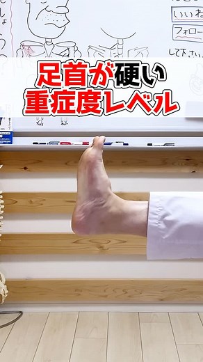 セルフケア教室 nobu先生@格闘家整体師 on Instagram: "足首が硬い重症度レベル‼️ 皆んなのレベルも教えてね？！🙏 やる！って方は『👍(グッド)』 後でやる！って方は『✋️(ちょっとまって)』 の絵文字やコメントで教えてね✨✨✨ 🏆無料公式LINE登録で豪華特典 🏆 【あなた専用のセルフケアは何か？】 簡単チェック出来るからやってみてね！ 最新！足踏み動画もプレゼント🎁 ⬇️プロフィールからプレゼント🙏 @nobu.639 🎁特典内容🎁 ━━━━━━━━━━━ ✅あなたのお悩みにあったケア動画🎁 ✅寝て・座って・立って出来る足踏み動画🎁 ✅悩み別セルフケア動画プレゼント🎁 ✅ピンポイントで痩せるケア動画🎁 ✅根本原因から体の悩みを改善させる方法プレゼント🎁 ━━━━━━━━━━━ コチラよりNobu先生の施術体験など健康の事も無料配信していきます！ ⬇️受け取り方法はプロフィールから🙏 @nobu.639 感想やリクエストは コメントでお待ちしてます🙇‍♂️ 効いたと思ってよかったら イイネ＆コメント✨ フォローもコチラから宜しくお願い致