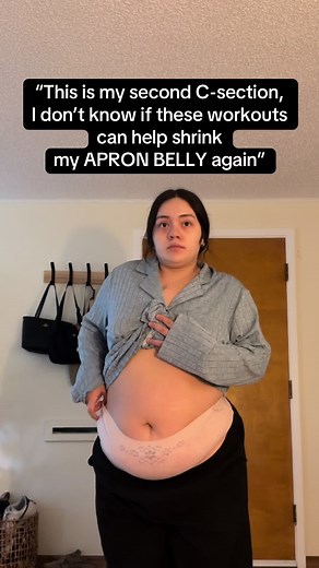 3 months & 3 weeks post repeat C-section and if I can do it, so can you! 🫶🏻 #apronbelly #fupa #diastasisrecti #diastasisrectiexercises #beginnerworkout