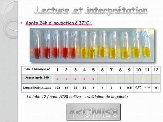 Determination de la CMI en milieu liquide