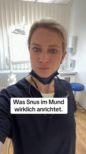Snus gilt für viele als „harmlos“, weil kein Rauch entsteht. Für die Mundgesundheit stimmt das leider nicht. Als Zahnärztin sehe ich regelmäßig typische Veränderungen: 1️⃣ Zahnfleischrückgang Der Snus-Beutel liegt oft immer an derselben Stelle im Mund. Das Zahnfleisch zieht sich dort zurück. 2️⃣ Freiliegende Zahnhälse Wenn das Zahnfleisch zurückgeht, werden Zahnhälse empfindlich auf kalt, süß oder sauer. 3️⃣ Schleimhautveränderungen Nikotin und Zusatzstoffe können die Mundschleimhaut sichtbar ve