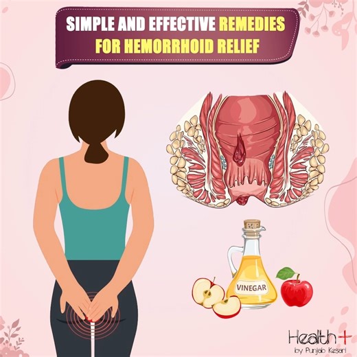 31K views · 192 reactions | Simple and Effective Remedies for Hemorrhoid Relief | Health+ | Facebook