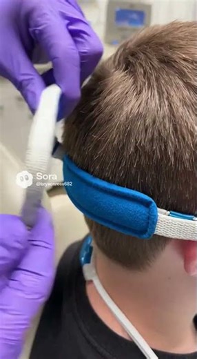 My Expander Headgear