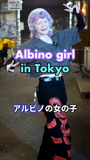 This girl related her experience growing up albino and her thoughts on the importance of acceptance. I think it's great that people from all walks of life can come here and be united by their interest and love of Japan 🗾😇 この少女は、アルビノとして育った経験と、受け入れることの大切さについて語りました。あらゆる階層の人々がここに来て、日本への興味と愛で結ばれるのは素晴らしいことだと思います。 #tokyointerviews #streetinterviews #acceptance #albino #albinism #cleftpalate