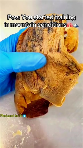 Take this lung training device with you anywhere to train your endurance💪 #athlete #breathtraining #footballplayer #trend #fyp