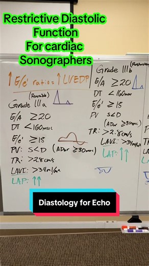 Final Cut of our Diastolic Dysfunction for Echo! #sonographystudent #echocardiography #ultrasound #fypシ #trendingvideo