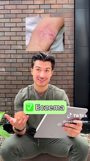 Identifying Common Skin Lesions for Medical Students
