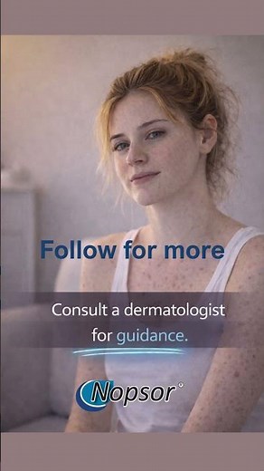 Most People Treat Guttate Psoriasis the Wrong Way | What Actually Works