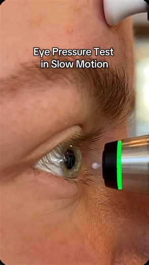 Eye Q Optometry on Instagram: "Would you rather get this or this air puff test? 👀 Comment your picks Below! #airpufftest #pressuretest #eyepressure #iop #eyecare #floaters #optometry #eyes #eyeq #optometrist #docsoftiktok #optitian #eyeexam #vision #eyeqoptometry #eyehealth #calgary #yyc"