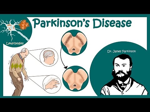 Parkinson's Disease (Shaking Palsy) | Clinical Presentation & Pathophysiology of Parkinson's disease