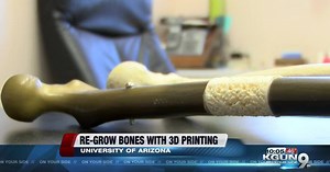 Can you re-grow a broken bone? That's what these university researchers are doing