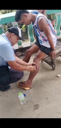 Amazing Pimple Popping Out NOW.😱😢 #pimplepop #satisfying | Great New top