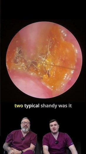 Dry Ear Wax vs Wet Ear Wax