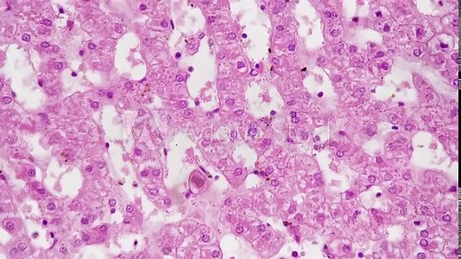 Section of human liver under microscope with 400 times magnification on bright field background. Scientific pattern of people organ responsible for detoxification of the organism. Anatomy research