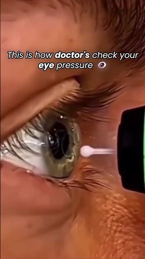 This is how doctors check your eye pressure 👀