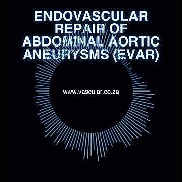 MET - 43 - Endovascular Repair of Abdominal Aortic Aneurysms EVAR - Brief