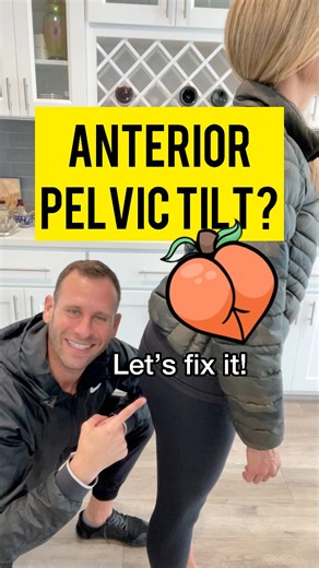 329K views · 1.2K reactions | Get rid of anterior pelvic tilt by doing this exercise consistently! #anteriorpelvictilt #glutesworkout #healthandwellness | PostureStrong | Facebook