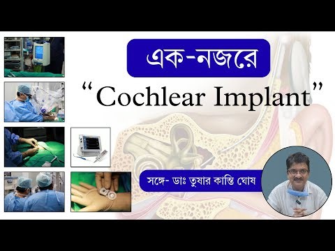 Cochlear Implant Procedure | Prelingual Patient | Dr. Tushar Kanti Ghosh | #cochlearimplant #ent