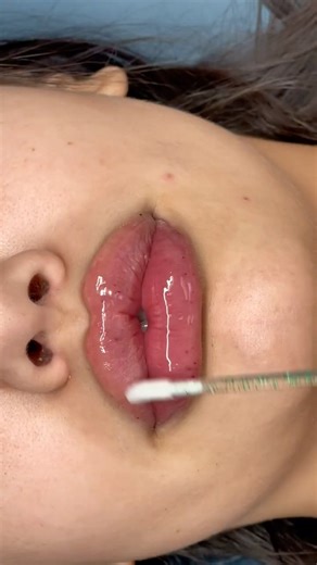 Perfecting My Microneedle Lip Filler Technique | Building My Beauty Empire