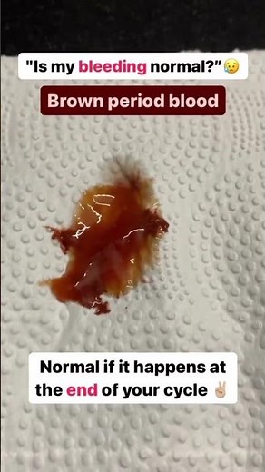 Is Your Bleeding Normal? Understanding Different Types of Bleeding