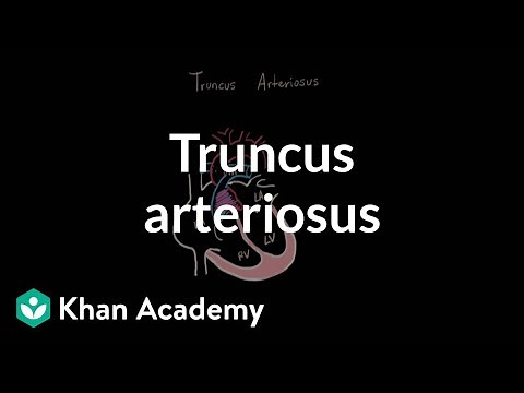 Truncus arteriosu | Circulatory System and Disease | NCLEX-RN | Khan Academy